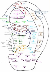 Acupuncture tips