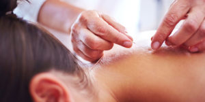 Acupuncture treatment