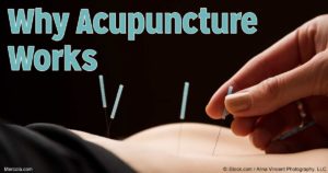 BodyMindSpirit Acupuncture and Wellness
